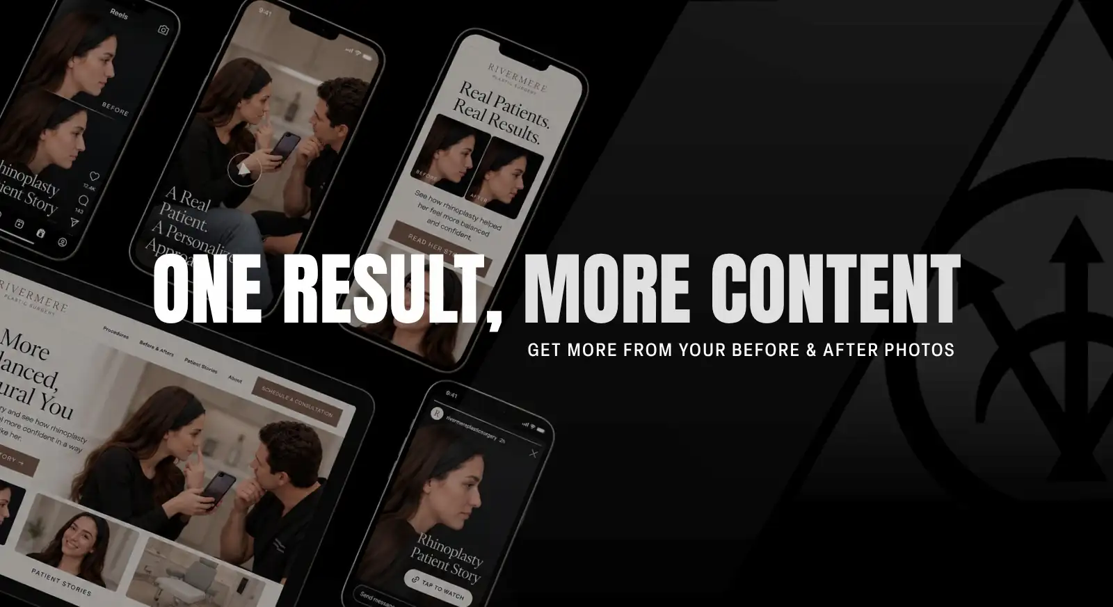 silvr blog thumbnail - leveraging before and after content creation